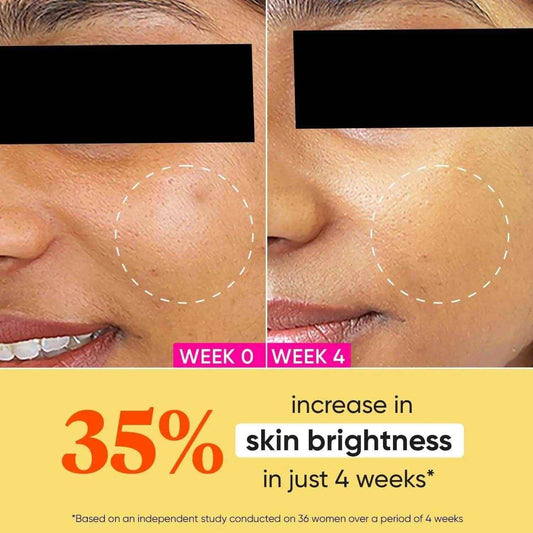 Dot & Key Vitamin C + E Sorbet Moisturizer – 25ml | Lightweight, Oil-Free Face Cream for Glowing Skin | Brightens & Hydrates | For All Skin Types